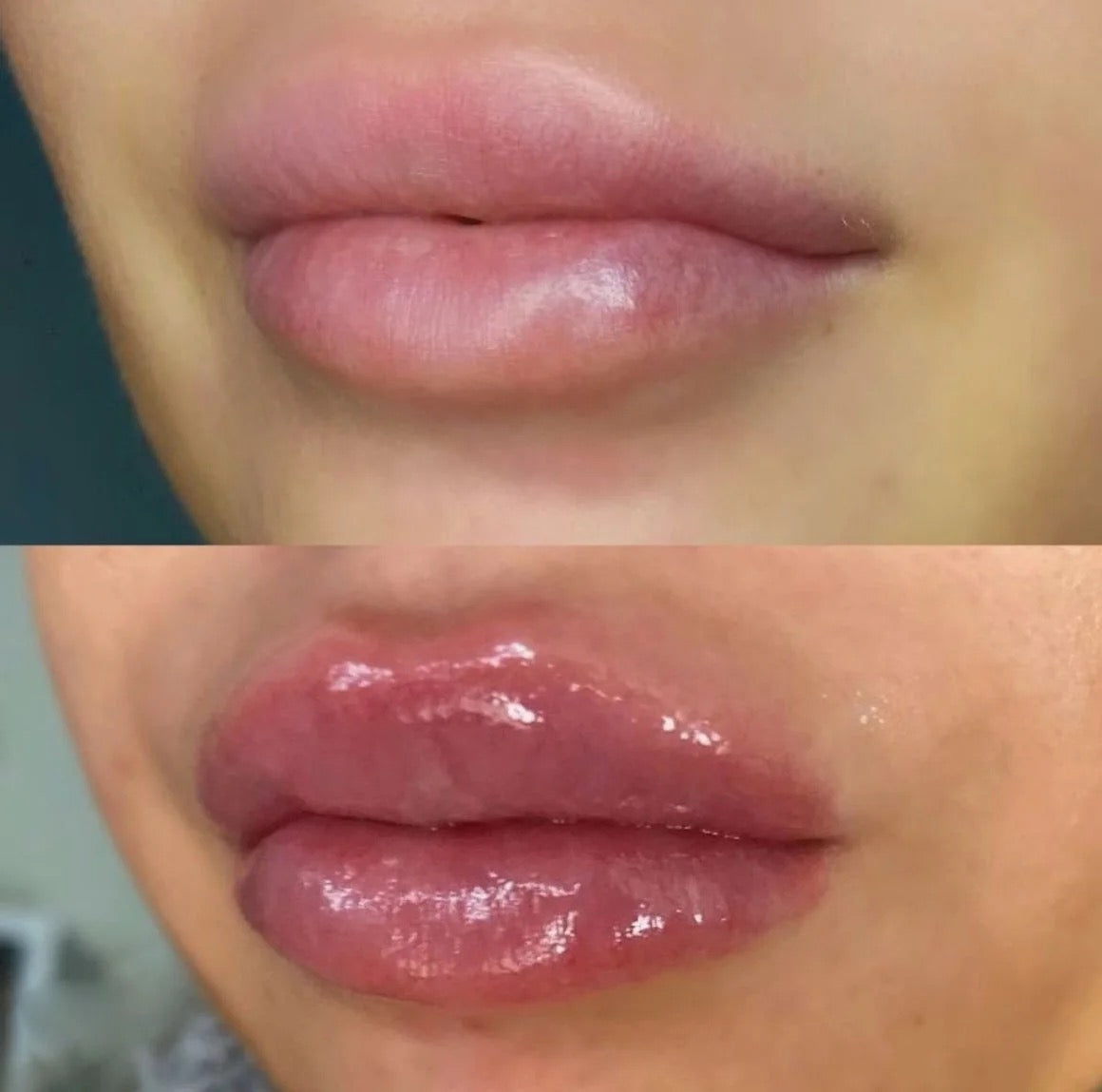 Bratz Doll Lip Plumper
